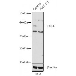 Polymerase DNA Directed Beta (POLB) Antibody