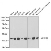 Western blot analysis of extracts of various cell lines, using AKR1B1 antibody (abx001414) at 1/1000 dilution.