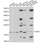 Western blot analysis of extracts of various cell lines, using CD59 antibody (abx001417) at 1/500 dilution.