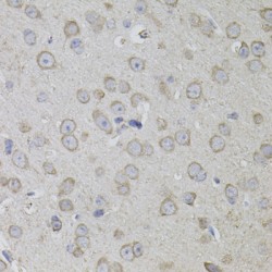 CD59 Glycoprotein (CD59) Antibody