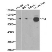 Western blot analysis of extracts of various cell lines, using F12 antibody (abx001419) at 1/1000 dilution.