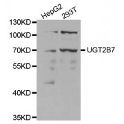 Western blot analysis of extracts of various cell lines, using µgT2B7 antibody (abx001420) at 1/1000 dilution.