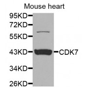 Western blot analysis of extracts of mouse heart, using CDK7 antibody (abx001421) at 1/1000 dilution.