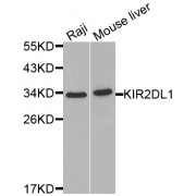 Western blot analysis of extracts of various cell lines, using KIR2DL1 antibody (abx001422) at 1/1000 dilution.