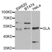 Western blot analysis of extracts of various cell lines, using GLA antibody (abx001425) at 1/1000 dilution.