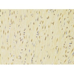 Heterogeneous Nuclear Ribonucleoprotein K (HNRNPK) Antibody