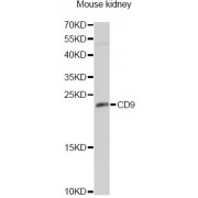 Western blot analysis of extracts of mouse kidney, using CD9 Antibody (abx001428) at 1/1000 dilution.