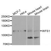 Western blot analysis of extracts of various cell lines, using WFS1 antibody (abx001429) at 1/1000 dilution.