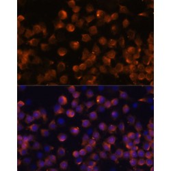 Complement Factor B (CFB) Antibody