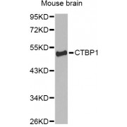 Western blot analysis of extracts of mouse brain, using CTBP1 Antibody (abx001431) at 1/1000 dilution.