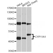 Western blot analysis of extracts of various cell lines, using CYP11A1 Antibody (abx001432) at 1/2000 dilution.