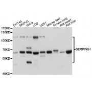 Western blot analysis of extracts of various cell lines, using SERPING1 antibody (abx001435) at 1/1000 dilution.