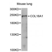 Western blot analysis of extracts of mouse lung, using COL18A1 antibody (abx001439) at 1/1000 dilution.