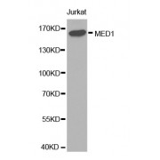 Western blot analysis of extracts of Jurkat cells, using MED1 antibody (abx001441).