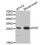 Western blot analysis of extracts of various cell lines, using PGF antibody (abx001442) at 1/1000 dilution.