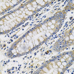 Placenta Growth Factor (PGF) Antibody