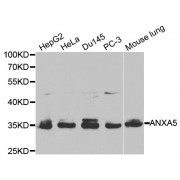 Western blot analysis of extracts of various cell lines, using ANXA5 antibody (abx001443) at 1/1000 dilution.