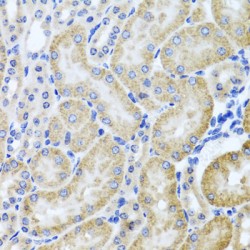 Histone Deacetylase 6 (HDAC6) Antibody