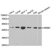 Western blot analysis of extracts of various cell lines, using NR0B1 antibody (abx001448) at 1/1000 dilution.