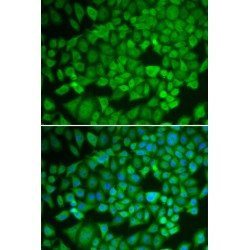 Nuclear Receptor Subfamily 0, Group B, Member 1 (NR0B1) Antibody