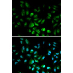 Upstream Stimulatory Factor 1 (USF1) Antibody