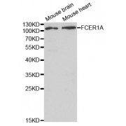 Western blot analysis of extracts of various cell lines, using FCER1A antibody (abx001456) at 1/1000 dilution.