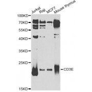 Western blot analysis of extracts of various cell lines, using CD3E Antibody (abx001457) at 1/1000 dilution.