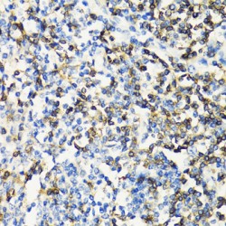 T-Cell Surface Glycoprotein CD3 Epsilon Chain (CD3E) Antibody
