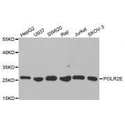 Western blot analysis of extracts of various cell lines, using POLR2E antibody (abx001458) at 1/1000 dilution.