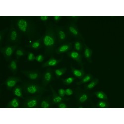 DNA-Directed RNA Polymerases I, II, And III Subunit RPABC1 (POLR2E) Antibody