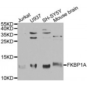 Western blot analysis of extracts of various cell lines, using FKBP1A antibody (abx001462) at 1/1000 dilution.