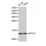Western blot analysis of extracts of various cell lines, using APOC2 antibody (abx001470).