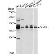 Western blot analysis of extracts of various cell lines, using CCND2 antibody (abx001471) at 1/1000 dilution.