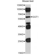Western blot analysis of extracts of mouse liver, using GGT1 antibody (abx001473) at 1/1000 dilution.