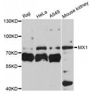 Western blot analysis of extracts of various cell lines, using MX1 antibody (abx001476) at 1:3000 dilution.