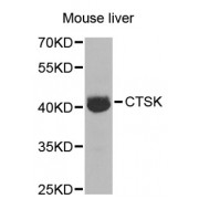 Western blot analysis of extracts of mouse liver, using CTSK antibody (abx001478) at 1/1000 dilution.