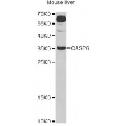 Western blot analysis of extracts of mouse liver, using CASP6 Antibody (abx001480) at 1/1000 dilution.