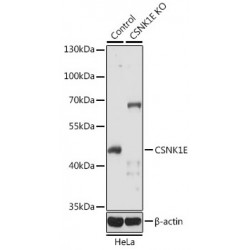 Casein Kinase I Isoform Epsilon (CSNK1E) Antibody
