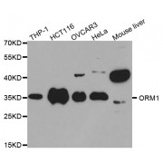 Western blot analysis of extracts of various cell lines, using ORM1 antibody (abx001490) at 1/1000 dilution.