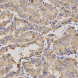 X-Ray Repair Cross-Complementing Protein 2 (XRCC2) Antibody