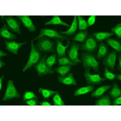 X-Ray Repair Cross-Complementing Protein 2 (XRCC2) Antibody