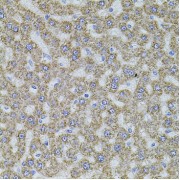 Immunohistochemistry of paraffin-embedded rat liver using ALDH1A1 antibody (abx001492) at dilution of 1/100 (40x lens).