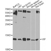 Western blot analysis of extracts of various cell lines, using VIP Antibody (abx001494) at 1/1000 dilution.