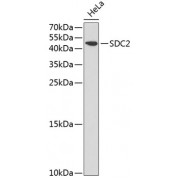 Western blot analysis of extracts of HeLa cells, using SDC2 antibody (1/1000 dilution).
