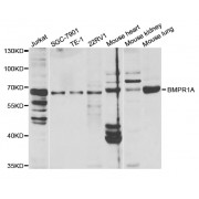Western blot analysis of extracts of various cell lines, using BMPR1A antibody (abx001501) at 1/1000 dilution.