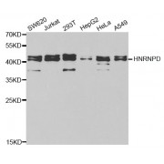 Western blot analysis of extracts of various cell lines, using HNRNPD antibody (abx001510) at 1/1000 dilution.