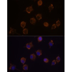 Interleukin 10 Receptor Alpha (IL10RA) Antibody