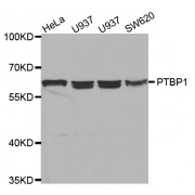 Western blot analysis of extracts of various cell lines, using PTBP1 antibody (abx001513) at 1/1000 dilution.