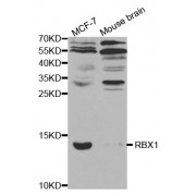 Western blot analysis of extracts of various cell lines, using RBX1 antibody (abx001514) at 1/1000 dilution.