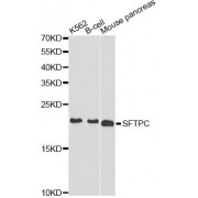 Western blot analysis of extracts of various cell lines, using SFTPC antibody (abx001517) at 1/1000 dilution.